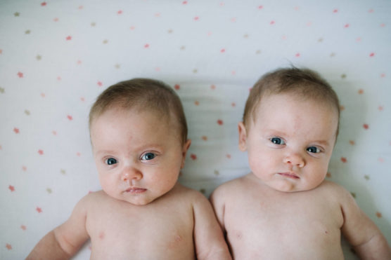 Two babies lying side by side on a white sheet with pink and beige polka dots, looking at the camera with neutral expressions. Both are shirtless and have light hair and blue eyes. by Justin Salem Meyer